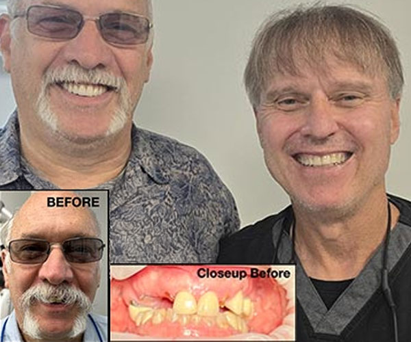 patient Before and after 008