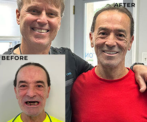 patient Before and after 005