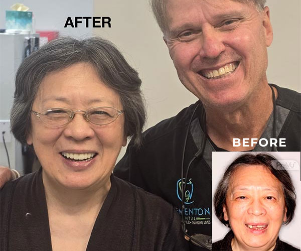 patient Before and after 011